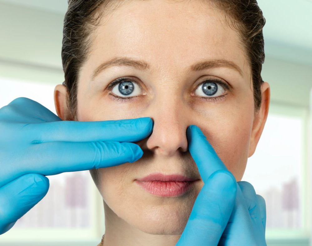 Nose Surgery (Rhinoplasty) Gallery